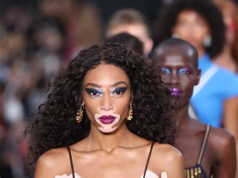 winnie harlow net worth|The 10 Richest Americas Next Top Model Contestants, Ranked。